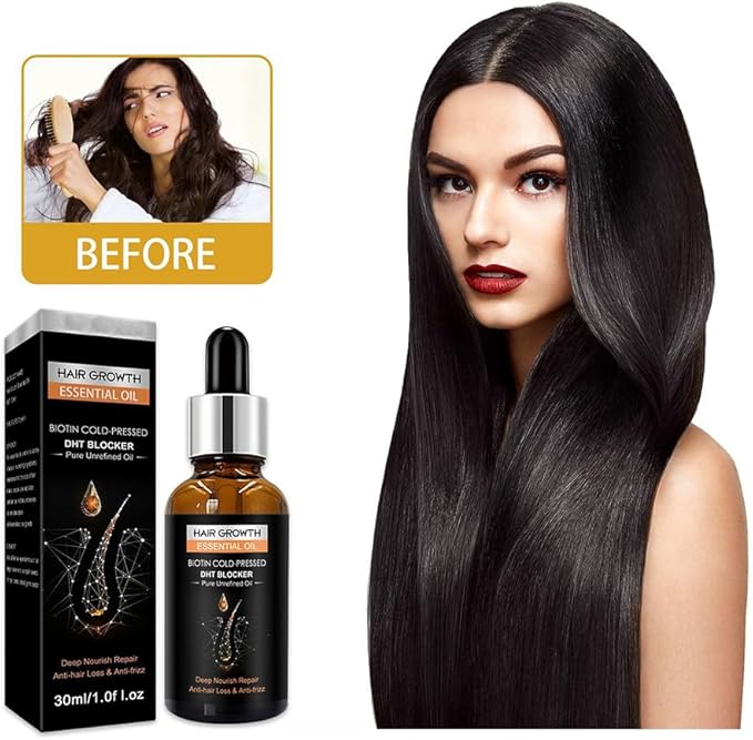 Hair Growth Essential Oil – Biotin & DHT Blocker